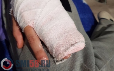 В Пензе мальчику загипсовали здоровые пальцы на руке