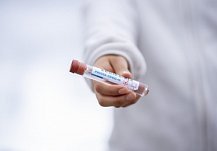 За сутки в Пензенской области подтвердились 597 тестов с коронавирусом